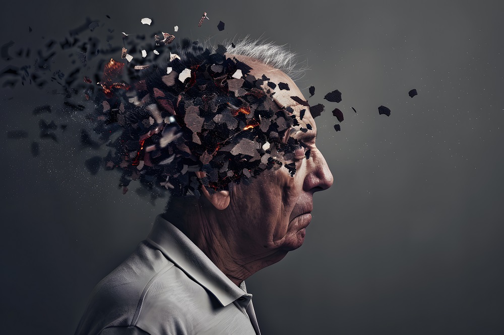 otthoni gondozás demencia esetén